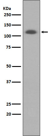 ABCG1 Rabbit Polyclonal Antibody