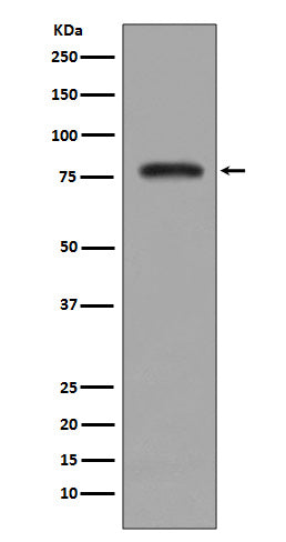 PKC beta 2 Rabbit Polyclonal Antibody