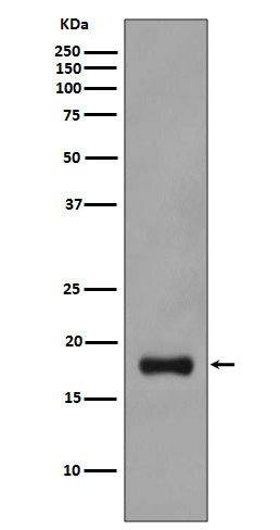 Stathmin 1 Rabbit Polyclonal Antibody