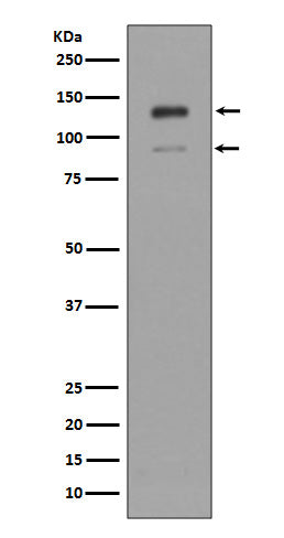 Interferon alpha/beta Receptor 1 Rabbit Polyclonal Antibody