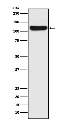 FAK Rabbit Polyclonal Antibody