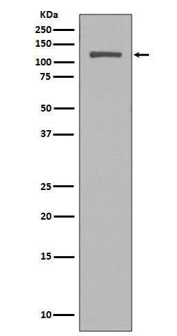 NUP98 Rabbit Polyclonal Antibody
