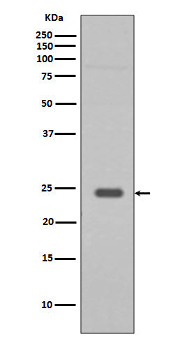 Rab9 Rabbit Polyclonal Antibody