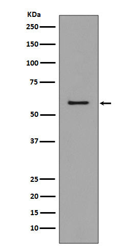 CCR3 Rabbit Polyclonal Antibody