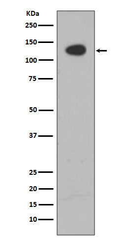 ATP Citrate lyase Rabbit Polyclonal Antibody