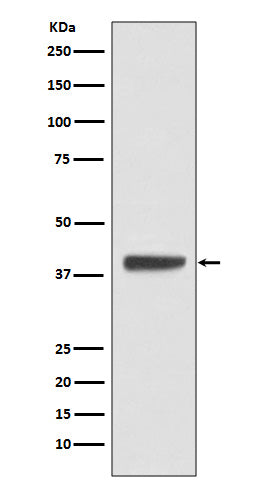 Islet 1 Rabbit Polyclonal Antibody