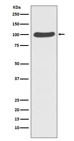 CTNNA1 Rabbit Polyclonal Antibody