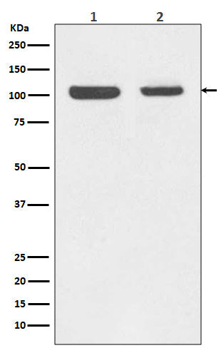 Rb Rabbit Polyclonal Antibody