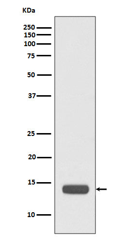 RPS20 Rabbit Polyclonal Antibody
