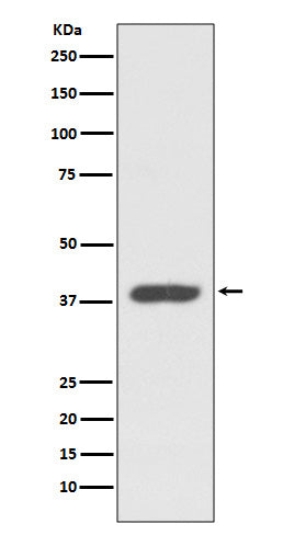 RDC1 Rabbit Polyclonal Antibody