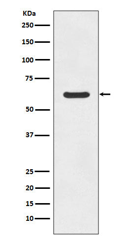 Asparagine Synthetase Rabbit Polyclonal Antibody