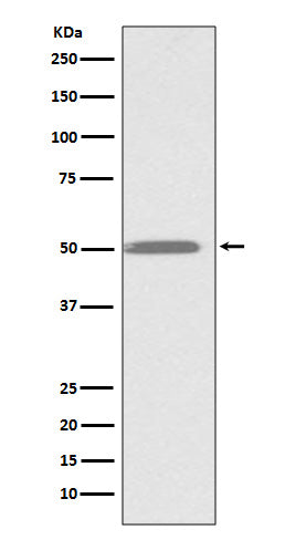 Integrin Linked ILK Rabbit Polyclonal Antibody