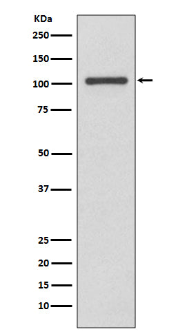 INPP4B Rabbit Polyclonal Antibody