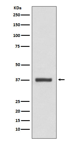 CDK6 Rabbit Polyclonal Antibody