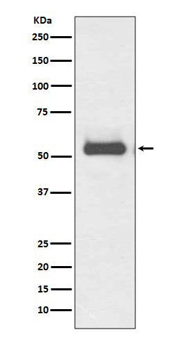 TFG Rabbit Polyclonal Antibody