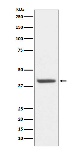 HDAC8 Rabbit Polyclonal Antibody