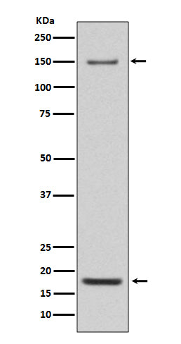 Integrin alpha 5 Rabbit Polyclonal Antibody