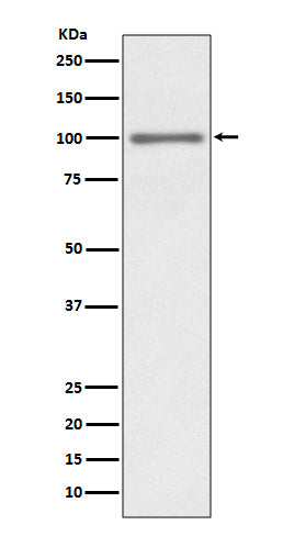 KMT6 Rabbit Polyclonal Antibody