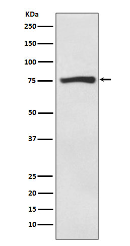 ACSS2 Rabbit Polyclonal Antibody