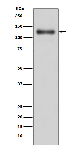 LAMP1 Rabbit Polyclonal Antibody