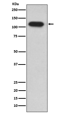 Insulin Degrading Enzyme Rabbit Polyclonal Antibody
