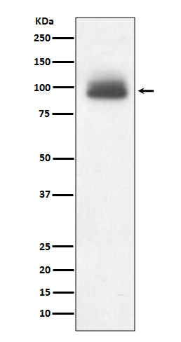 Glucocorticoid Receptor Rabbit Polyclonal Antibody