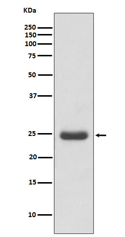 Thymidine Kinase Rabbit Polyclonal Antibody
