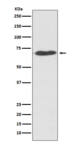 PDIA2 Rabbit Polyclonal Antibody