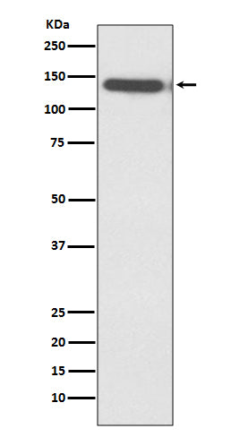 Ctip2 Rabbit Polyclonal Antibody