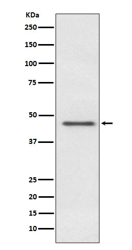 Pyruvate Dehydrogenase E1 alpha Rabbit Polyclonal Antibody
