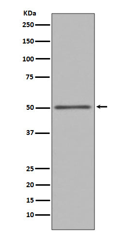 FOXA1 Rabbit Polyclonal Antibody