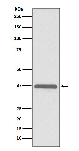ERCC1 Rabbit Polyclonal Antibody