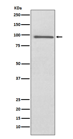 PROX1 Rabbit Polyclonal Antibody