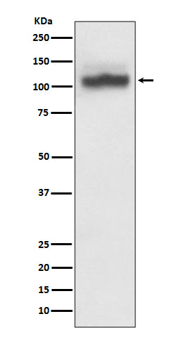 SERCA2 ATPase Rabbit Polyclonal Antibody