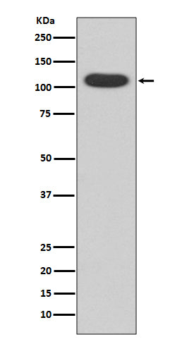 Aryl Hydrocarbon Receptor Rabbit Polyclonal Antibody