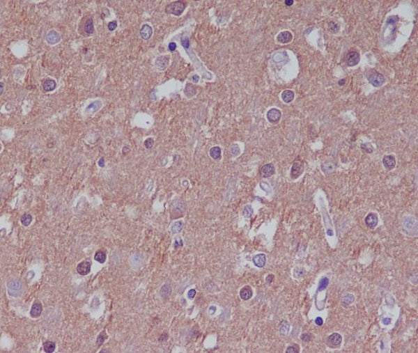 Substance P Rabbit Polyclonal Antibody