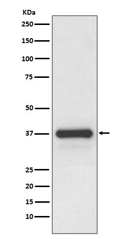 Podoplanin Rabbit Polyclonal Antibody