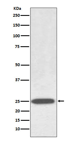 Aquaporin 1 Rabbit Polyclonal Antibody