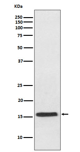VAMP2 Rabbit Polyclonal Antibody