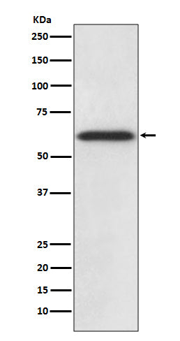 Catalase Rabbit Polyclonal Antibody