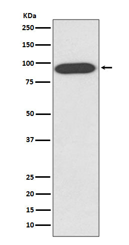 VCP Rabbit Polyclonal Antibody