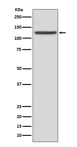 Integrin alpha IIb Rabbit Polyclonal Antibody