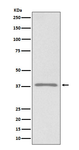Podoplanin Rabbit Polyclonal Antibody