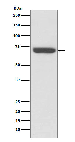 TNF Receptor 2 Rabbit Polyclonal Antibody
