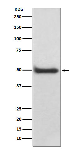 CaMKII delta Rabbit Polyclonal Antibody
