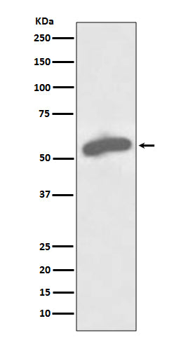 Glucose 6 Phosphate Dehydrogenase Rabbit Polyclonal Antibody