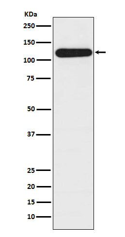 BUBR1 Rabbit Polyclonal Antibody