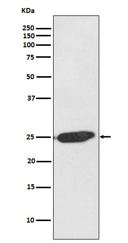 SNAP25 Rabbit Polyclonal Antibody
