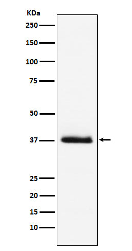 Parathyroid Hormone Rabbit Polyclonal Antibody