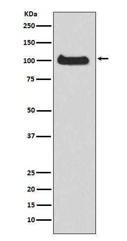 PKD1 Rabbit Polyclonal Antibody